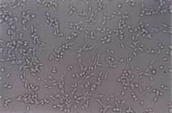 control fibrosarcoma cells, myko san experiment
