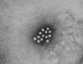 infekcija virusa tipa hepatitis, HIV, prehlade ili gripe započinje uspješnim prodorom virusa u stanicu